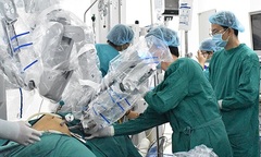 Lần đầu tiên dùng robot phẫu thuật trong phẫu thuật ung thư thực quản