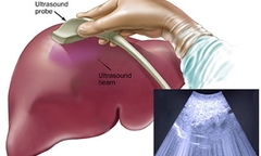 Những hành động sau cứu sống bạn khi lá gan có vấn đề