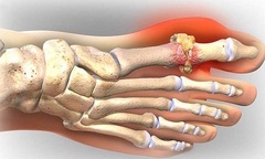 Không chịu tin lời chẩn đoán của bác sĩ, một phụ nữ nôn ra máu nguy kịch