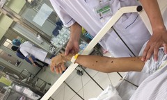 Chuyên gia mách nước thoát khỏi nguy hiểm khi bị ong đốt