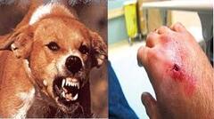 Cục Quản lý Dược tiếp tục thông tin việc cung ứng vắc xin phòng dại