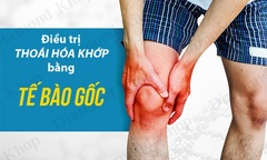Điều trị thoái hóa khớp gối bằng tiêm tế bào gốc: Bước đột phá của y học