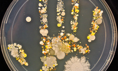 Mùa lạnh: Bị viêm phổi, tử vong chỉ vì... tay bẩn