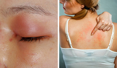 8 tác dụng phụ của thuốc kháng sinh bác sĩ hiếm khi cho biết