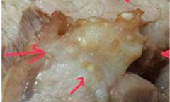 Những loại thực phẩm dễ ẩn chứa ấu trùng, giun sán bà nội trợ nên biết