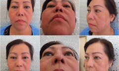 Bác sĩ Lê Văn Sẽ - Địa chỉ cứu cánh của những ca phẫu thuật hỏng