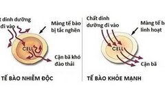 Dấu hiệu cảnh báo cơ thể nhiều độc tố cần phải thải độc ngay
