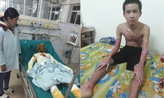 Sự sống hồi sinh với tấm thẻ màu xanh…