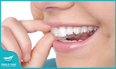 7 hiểu lầm tai hại về chỉnh nha Invisalign bạn cần biết