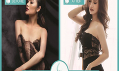 Nâng ngực giá bao nhiêu tiền để có vòng 1 đẹp tự nhiên, quyến rũ