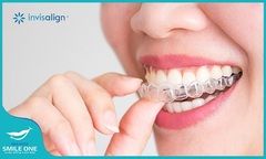 Lựa chọn niềng răng bằng khay trong suốt, những điều sẽ khiến bạn  "nghe xong chọn ngay " 