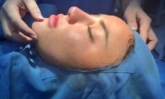 Quán quân Sao Mai điểm hẹn rạng ngời sau làm đẹp tại Thẩm mỹ viện Smiley 