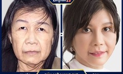 U40-50 da căng bóng đẹp như thuở đôi mươi