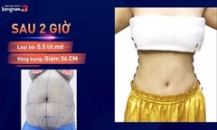 Những sai lầm “tai hại” về việc ăn kiêng khiến bạn mãi chẳng giảm cân nổi!