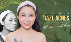 Dịch vụ chăm sóc da mặt tại Viện thẩm mỹ TOKYO ISEA 