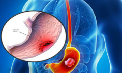 Yakumi – Tạm biệt nỗi lo bệnh đau dạ dày tái phát!