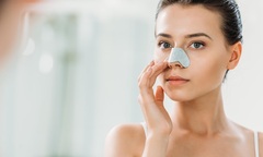 Nguyên nhân gây ra mụn cám và các sản phẩm skincare cho da mụn