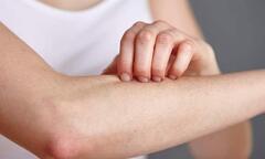 Bác sĩ Dược Sài Gòn tư vấn cách phòng tránh dị ứng thời tiết