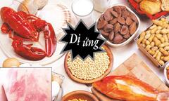 Chuyên gia Dược Sài Gòn hướng dẫn cách xử trí khi bị dị ứng thực phẩm