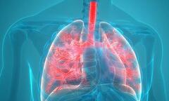 Cùng Bác sĩ Dược Sài Gòn tìm hiểu một số bệnh phổi thường gặp