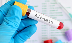 Cùng Bác sĩ Dược Sài Gòn tìm hiểu về vai trò của Albumin trong cơ thể
