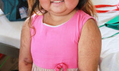 Chuyện buồn của bé gái đảo Lý Sơn có ngoại hình khác thường