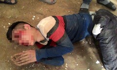 Truy đuổi hai “cẩu tặc”, nhiều người dân bị chém thương tích