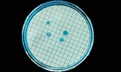 Vi khuẩn bám đầy điện thoại- người dùng coi chừng 