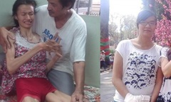 Đau đớn nữ sinh mắc chứng bệnh hiếm gặp, dang dở giấc mơ tới trường