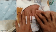 Bé sơ sinh có chiếc đuôi dài 10cm mọc từ lưng  "gây sốt " mạng xã hội