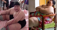 Cậu bé 14 tuổi nặng 180kg khóc xin bác sĩ giúp giảm cân giờ ra sao?
