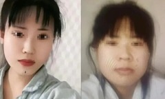 Phẫu thuật thẩm mỹ thất bại, cô gái quẫn trí nhảy sông tự tử: Tin nhắn gửi mẹ gây chú ý