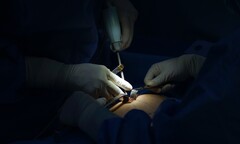 Nâng ngực bằng dao siêu âm thế hệ mới có những ưu điểm nào 