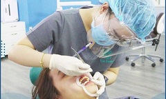 Trung tâm chỉnh nha Uni Dental có tốt không?