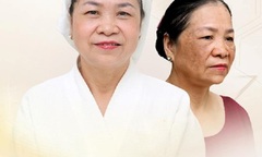 Thẩm Mỹ Viện Quốc Tế Bắc Mỹ Địa Chỉ Trị Nám Số 1 Tại Vinh