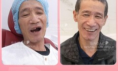 Nha khoa Singae dental - Hệ thống chăm sóc răng uy tín tại Việt Nam 