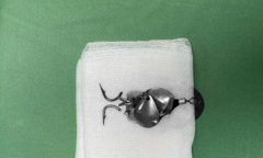 Phú Thọ: Bé trai bị lưỡi câu móc vào mắt trong lúc xem câu cá