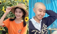 Ngôi sao nhí được yêu thích nhất Trung Quốc phẫu thuật u não thành công