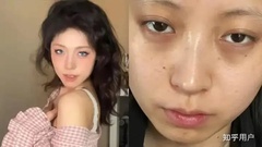 Ngoại hình xuống sắc sau 1 năm đi làm, cô gái được công ty bồi thường hơn 30 triệu đồng để làm đẹp