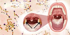 Phát hiện thêm một ca dương tính với bạch hầu ở Bắc Giang