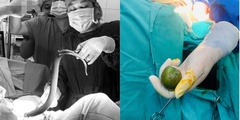 Cứu sống nam thanh niên ngoại quốc nhét lươn, chanh vào hậu môn
