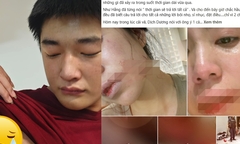 Câu nói xé lòng của Dịch Dương khi thấy Hằng Du Mục bị bố đánh đập dã man