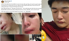 Toàn cảnh vụ Hằng Du Mục bị chồng đánh đập dã man, Dịch Dương bị thương vì lao vào bảo vệ