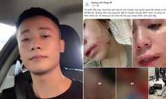 Động thái gây chú ý của Quang Linh Vlogs khi Hằng Du Mục bị chồng đánh đập dã man