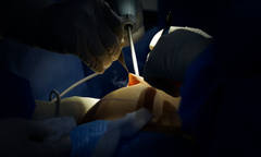 Bác sĩ Hồ Cao Vũ độc quyền công nghệ Harmo-5K trong thẩm mỹ nâng ngực  