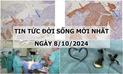 Tin tức đời sống 8/10/2024:Ho khan 1 tháng, đi khám phát hiện mắc 2 bệnh ung thư