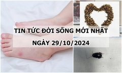 Tin tức đời sống 29/10/2024: Hà Nội ghi nhận thêm ca mắc não mô cầu