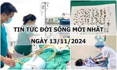 Tin tức đời sống 13/11/2024: Phát hiện 172 viên sỏi trong túi mật người phụ nữ