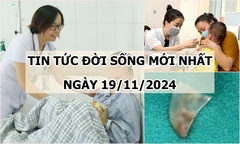 Tin tức đời sống 19/11/2024: Bác sĩ kịp thời cứu cháu bé bị cửa cuốn kẹp vào cổ