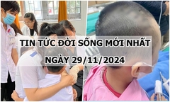 Tin tức đời sống 29/11/2024: Nguyên nhân khiến bé 7 tuổi bị hoại tử da đầu